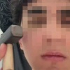 Зумеры по всей России массово бьют себя молотками по лицу, чтобы стать красивее.