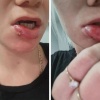Сосед избил женщину из-за пения Позавчера около полуночи 37-летняя Антонида...