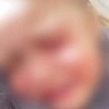 В Тюмени бойцовская собака напала на маленькую девочку и едва не разорвала ей лицо