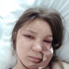Екатеринбуржец несколько месяцев избивает супругу В микрорайоне 