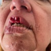 Поцелуй с собакой обернулся для бразильянки потерей губы