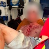 В Киеве 19-летний студент набросился с ножом на трех мужчин: один из пострадавших в коме