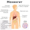 Всплеск смертельно опасного менингита наблюдается в России из-за трудовых мигрантов — Минздрав