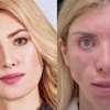 Страшная история модели из Сочи, которая почти шесть лет судилась с клиникой, получила финал