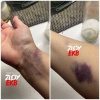 Жительница Верхней Пышмы пожаловалась на плохие условия в местной больнице