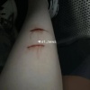 В Екатеринбурге стая собак напала на 16-летнюю девушку по дороге в колледж