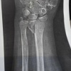 В Санкт-Петербурге самокатчик сбил 80-летнюю бабушку и уехал, оставив ее