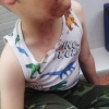Пёс изуродовал лицо 4-летнего ребёнка на пути к пляжу под Петербургом