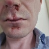 Подростки с цепями и металлическими прутьями избили мужчин в Перми