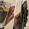 Телефон взорвался в кармане штанов 13-летнего подростка в Подмосковье.
