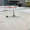 В Нижнем Тагиле медики спасли мужчину, проглотившего иголку, которая оказалась в стопке с водкой