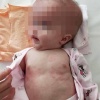 В Подмосковье родители требуют 15 млн рублей у больницы после ошибки врачей, сделавшей ребёнка инвалидом