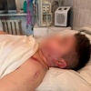 Поездка на аттракционе обернулась для школьника переломом позвоночника и потерей двух пальцев на ноге