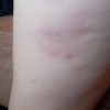Собака набросилась на ребёнка возле школы №3 в Ачинске