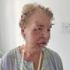 В Екатеринбурге подростки на электросамокате сбили 77-летнюю пенсионерку