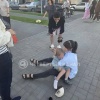 Опухший глаз и большой синяк: появились фото последствий наезда самокатчика на ребёнка