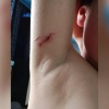 В Тюхтете с владельцев бойцовских собак требуют компенсацию за покусанных...