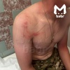 Погоня ДПСника и подростка на квадрике в Тайшете закончилась травмами для...