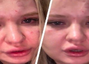 Толпа девочек-подростков повалила женщину и отпинала её по лицу в Ишимбае