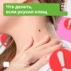 🪲 Что делать при укусе клеща — рассказали жителям Приморья По данным от...