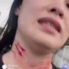 Жесть из Казахстана: там девушка на стриме ходила по улице и резала себе горло стеклом.