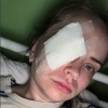 Жительница Перми получила пулю в глаз на пробежке. Врачи утверждают, что пострадавшая может остаться без глаза