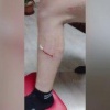 30 тысяч рублей за нападение собаки на ребенка в Копьево заплатят власти....