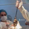 Хирурги достали из желудка молодой девушки полукилограммовый ком волос....