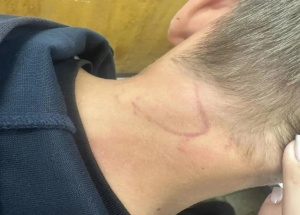 В Новосибирске подростки избили 12-летнего мальчика, отказавшегося отдать...