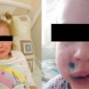 В Брянске с хозяйки кане-корсо требует полмиллиона за укус 4-летней девочки