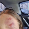 На Европейском проспекте мужчина на СИМ сбил 8-летнюю девочку и скрылся. У ребёнка — ушибы и ссадины.