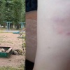 Бастрыкин потребовал отчёт по нападениям собак на детей в Ачинске. После...