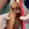 В Виннице (Украина) мальчик чуть не потерял руку из-за спасения кота