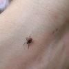 В Новосибирской области пять человек умерли от клещевого энцефалита В этом...