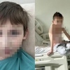 Полуметровую струну от катетера, которую забыли в теле мальчика, смогли удалить