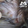 Личинки мух выросли в голове годовалого ребёнка в Новосибирске. По словам...