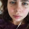 Редкую болезнь Верльгофа обнаружили у 24-летней москвички после того, как её...