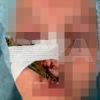 В Подмосковье парень пошёл на леща и поймал сам себя.