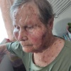 85-летнюю вдову участника ВОВ жестоко избили до потери сознания из-за дома в Приморье