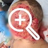 В Оренбургской области малолетняя сестра завела трактор и сбила брата: врачи с трудом восстановили ему лицо
