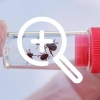 В соседнем Новосибирске четыре клеща впились во влагалище женщины во время полового акта в сквере