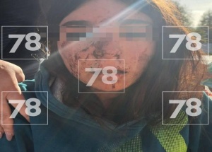 16-летнюю девочку жестоко избили в посёлке Назия