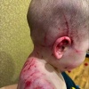 В Челябинске собака растерзала двоих детей, пока мать развлекалась с любовником в машине.
