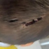 В Кызыле возбуждено уголовное дело по факту жестокого обращения с четырёхлетним ребёнком