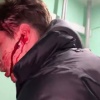 Ебн*тый Неадекватный зумер под наркотой покромсал друга ножом