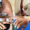 🐍🚑Более 20 человек стали пациентами Тысячекоечной больницы после встречи с ядовитыми змеями