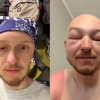 «Я не мог открыть глаз»: у новосибирца распухла голова после катания на сапе