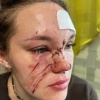В кировском ночном клубе медсестра 