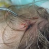 В Городской детской больнице скорой помощи успешно удалили восемь личинок...