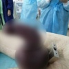 Сексуальный экстрим из Махачкалы: мужчина надел себе на половой орган замок и не смог снять